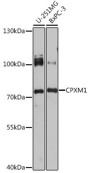 CPXM1 Rabbit Polyclonal Antibody