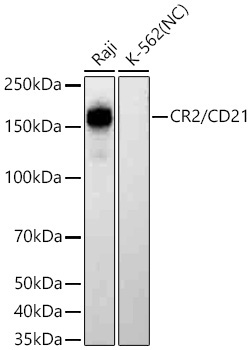 CR2/CD21 Rabbit Monoclonal Antibody