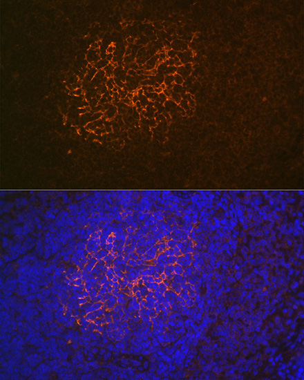 CR2/CD21 Rabbit Monoclonal Antibody - Image 2