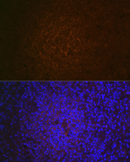 CR2/CD21 Rabbit Monoclonal Antibody - Image 3