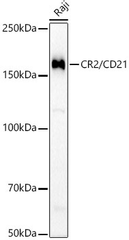 CR2/CD21 Rabbit Monoclonal Antibody