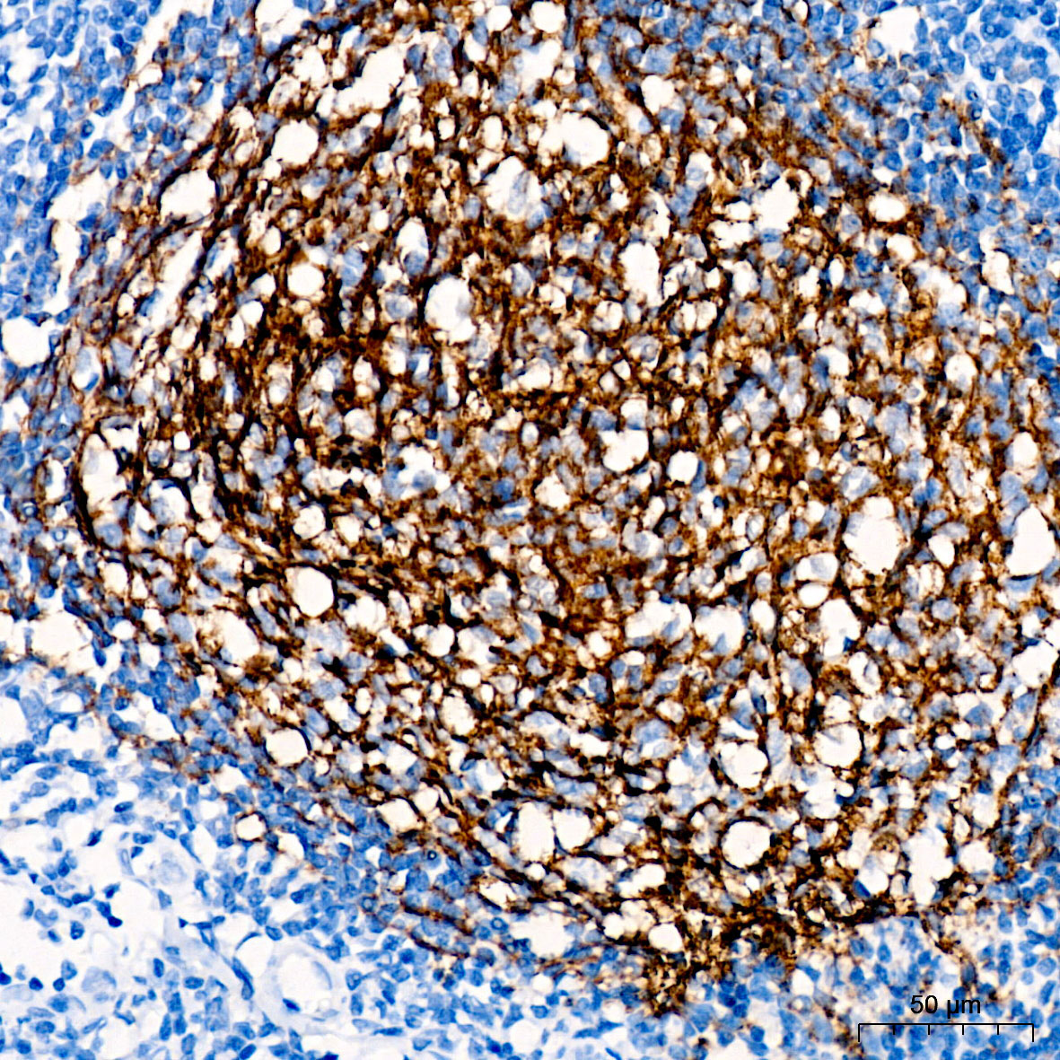 CR2/CD21 Rabbit Monoclonal Antibody - Image 2