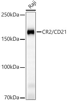 CR2/CD21 Rabbit Monoclonal Antibody