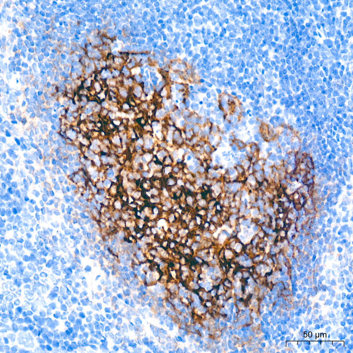 CR2/CD21 Rabbit Monoclonal Antibody - Image 2