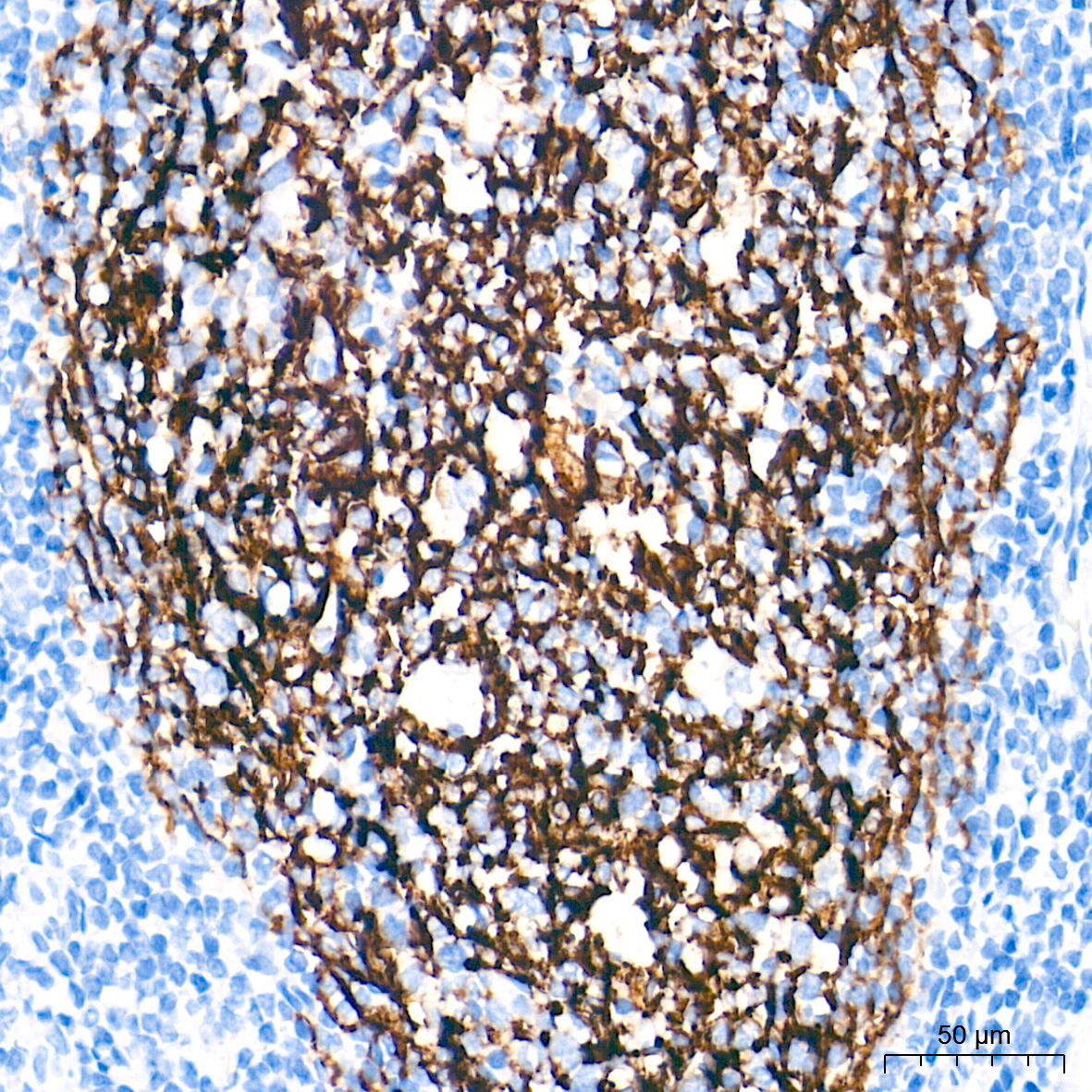 CR2/CD21 Rabbit Monoclonal Antibody - Image 3