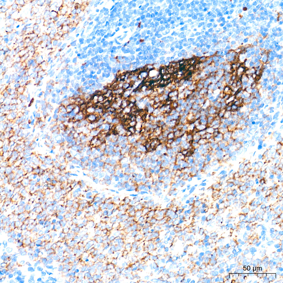 CR2/CD21 Rabbit Monoclonal Antibody - Image 4