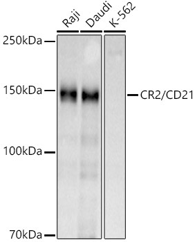 CR2/CD21 Rabbit Polyclonal Antibody
