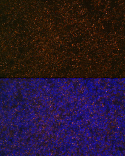 CR2/CD21 Rabbit Polyclonal Antibody - Image 3