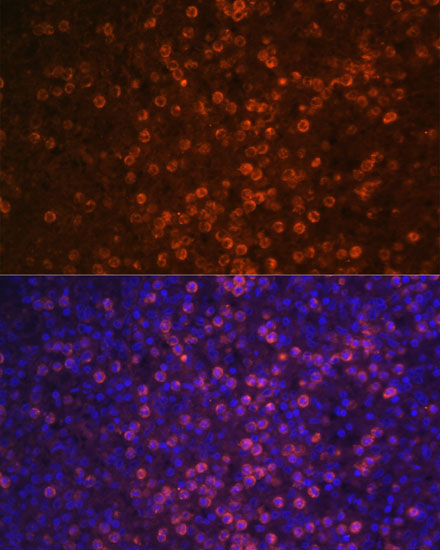 CR2/CD21 Rabbit Polyclonal Antibody - Image 4