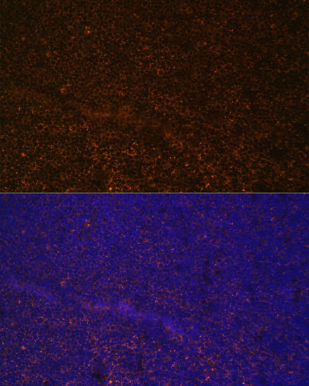 CR2/CD21 Rabbit Polyclonal Antibody - Image 5