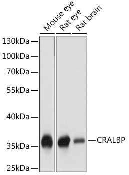 CRALBP Rabbit Polyclonal Antibody