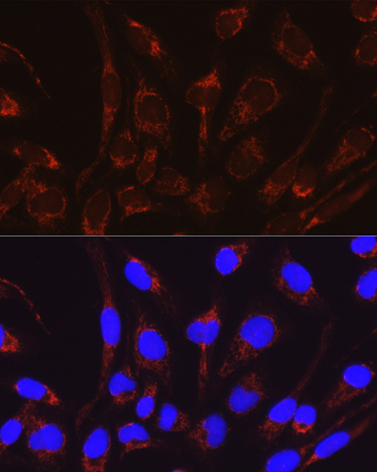 CRAT Rabbit Polyclonal Antibody - Image 2