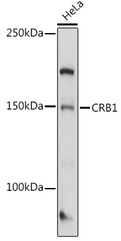 CRB1 Rabbit Polyclonal Antibody