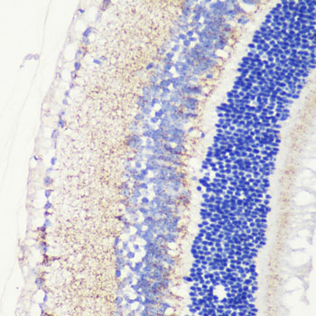 CRB1 Rabbit Polyclonal Antibody - Image 2
