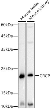 CRCP Rabbit Monoclonal Antibody