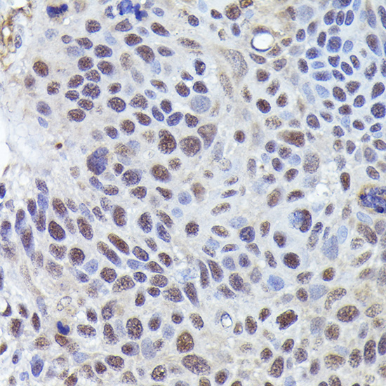 CRCP Rabbit Polyclonal Antibody - Image 2