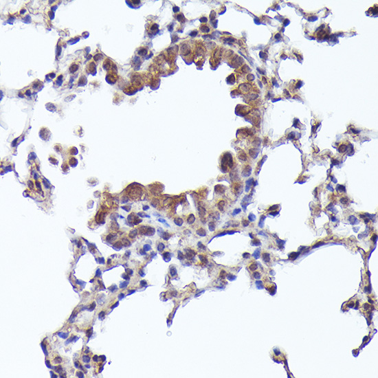 CRCP Rabbit Polyclonal Antibody - Image 3