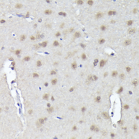 CRCP Rabbit Polyclonal Antibody - Image 4