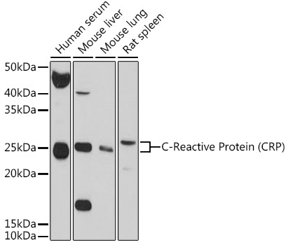 C-Reactive Protein (CRP) Rabbit Polyclonal Antibody