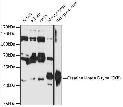 Creatine kinase B type (CKB) Rabbit Polyclonal Antibody