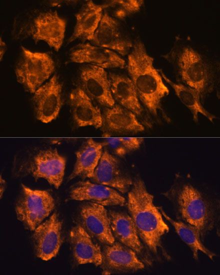 CRELD1 Rabbit Polyclonal Antibody - Image 2