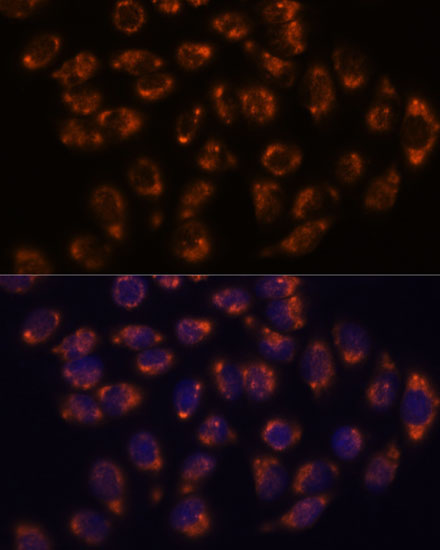 CRELD1 Rabbit Polyclonal Antibody - Image 3