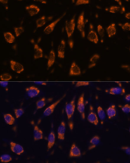 CRELD1 Rabbit Polyclonal Antibody - Image 4