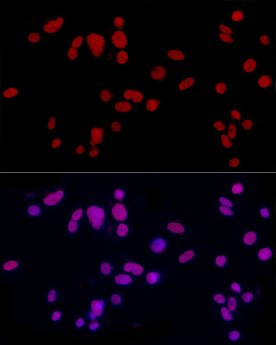 CREM Rabbit Polyclonal Antibody - Image 2
