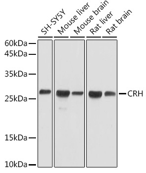 CRH Rabbit Polyclonal Antibody