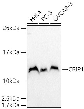 CRIP1 Rabbit Polyclonal Antibody
