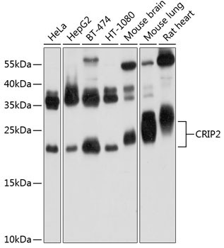 CRIP2 Rabbit Polyclonal Antibody