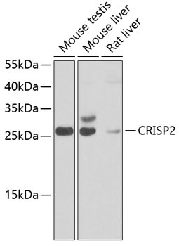 CRISP2 Rabbit Polyclonal Antibody
