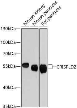 CRISPLD2 Rabbit Polyclonal Antibody