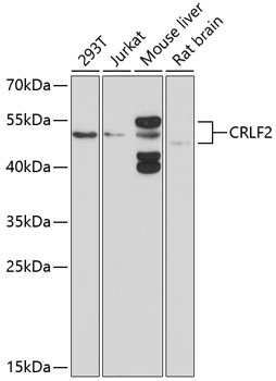 CRLF2 Rabbit Polyclonal Antibody