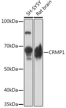 CRMP1 Rabbit Monoclonal Antibody