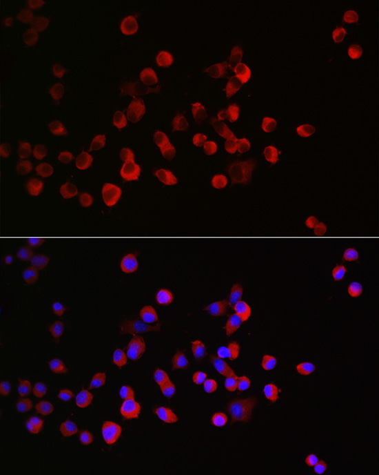 CRMP1 Rabbit Polyclonal Antibody - Image 2