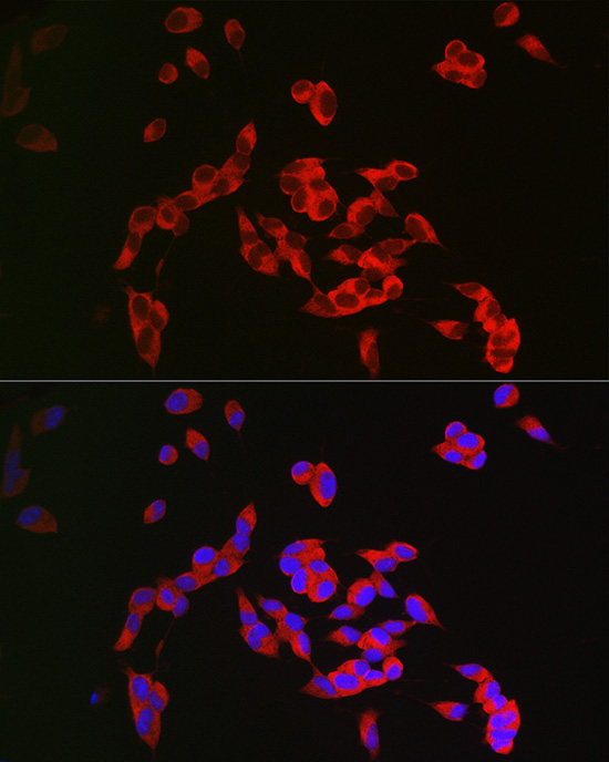 CRMP1 Rabbit Polyclonal Antibody - Image 3