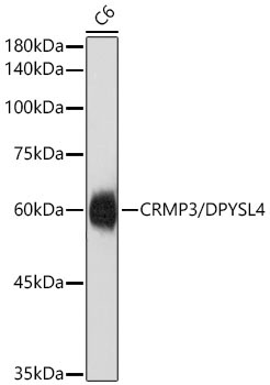 CRMP3/DPYSL4 Rabbit Monoclonal Antibody