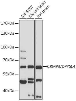 CRMP3/DPYSL4 Rabbit Polyclonal Antibody