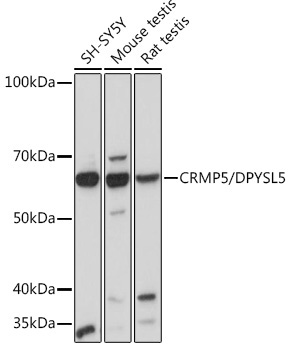 CRMP5/DPYSL5 Rabbit Monoclonal Antibody