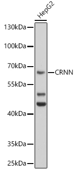 CRNN Rabbit Polyclonal Antibody