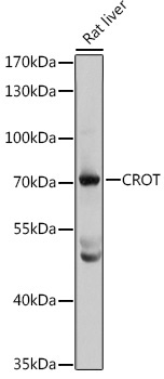 CROT Rabbit Polyclonal Antibody