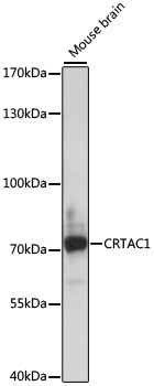 CRTAC1 Rabbit Polyclonal Antibody
