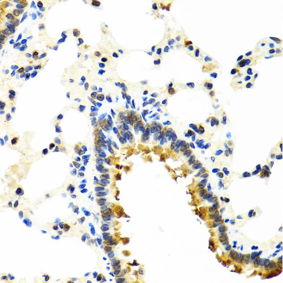 CRTAP Rabbit Polyclonal Antibody - Image 2