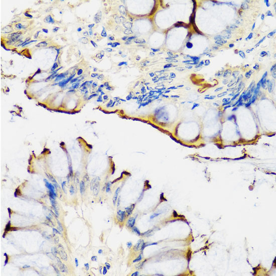 CRTAP Rabbit Polyclonal Antibody - Image 3
