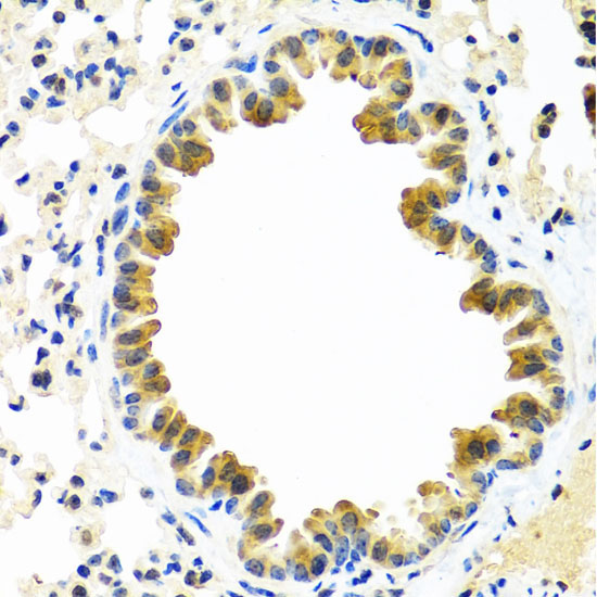 CRTAP Rabbit Polyclonal Antibody - Image 4