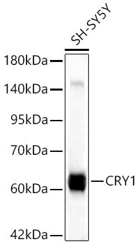 CRY1 Rabbit Polyclonal Antibody