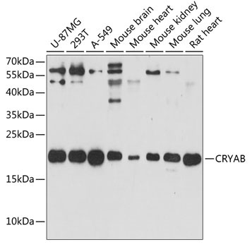 CRYAB Rabbit Polyclonal Antibody