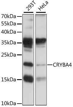 CRYBA4 Rabbit Polyclonal Antibody
