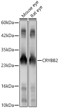 CRYBB2 Rabbit Polyclonal Antibody - Image 2